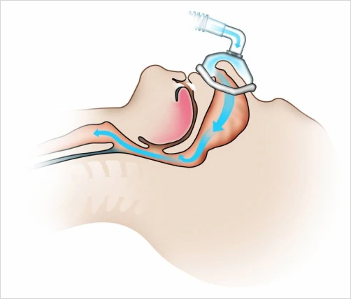 clinica fisioterapia respiratoria sp bh apneia sono ()